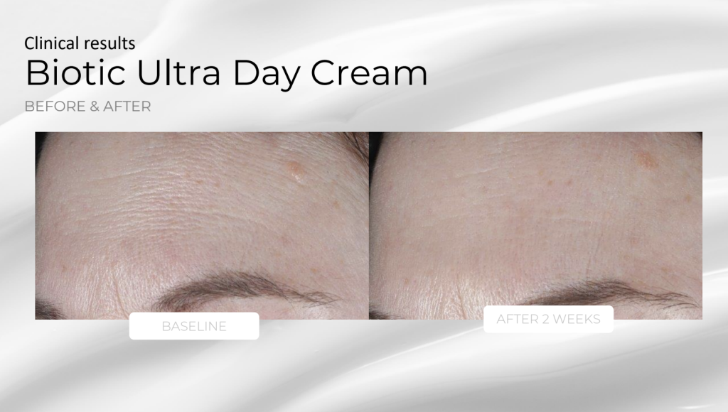 Biotic Ultra Day Cream – product details, medical-grade skincare by Zahav Medspa